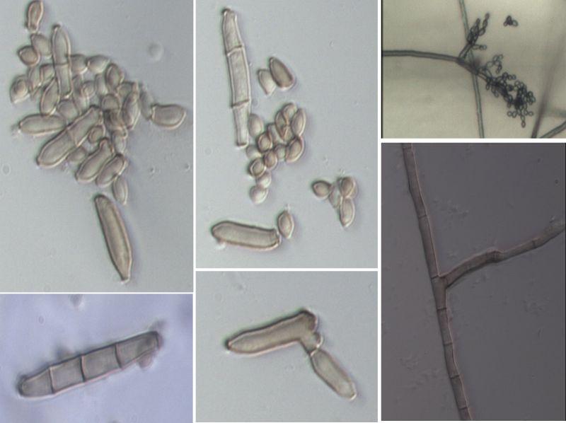 3-9>Cladosporium tenuissimu, C.