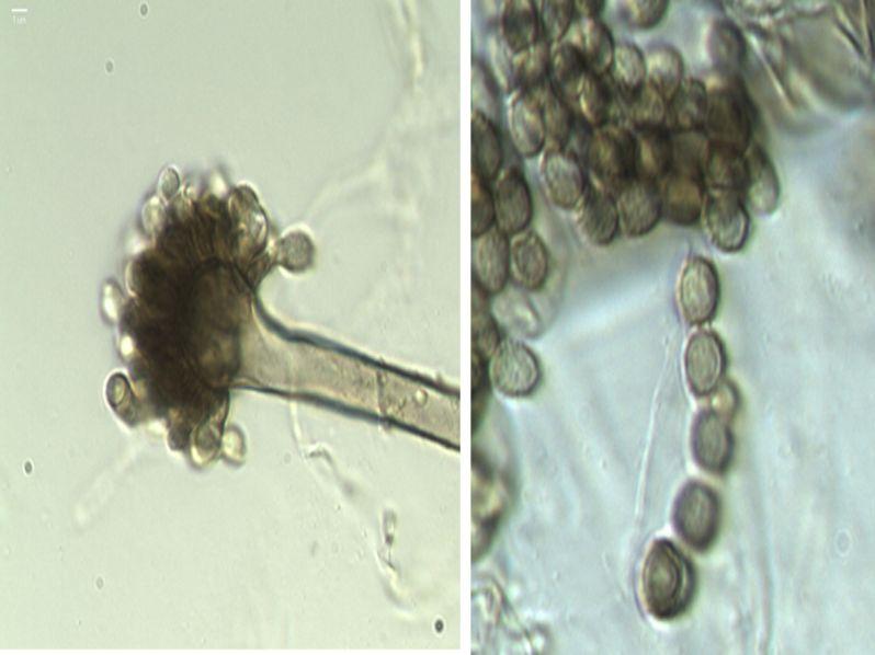 uredinicola Eurotium amstelodami < 그림세부