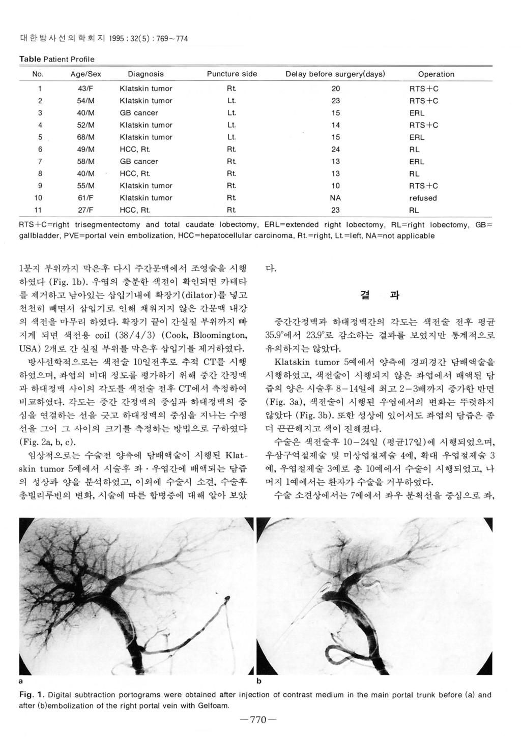 대한방사선의학회지 1995: 32(5): 769-774 Tble Pti en t Prolile No Age/Sex Di gnosis Pu ncture side Dely belore surgery(dys) Opertion 43/F Kltski n tu mor Rt 20 RTS +C 2 54/M Kltskin tumor Lt.