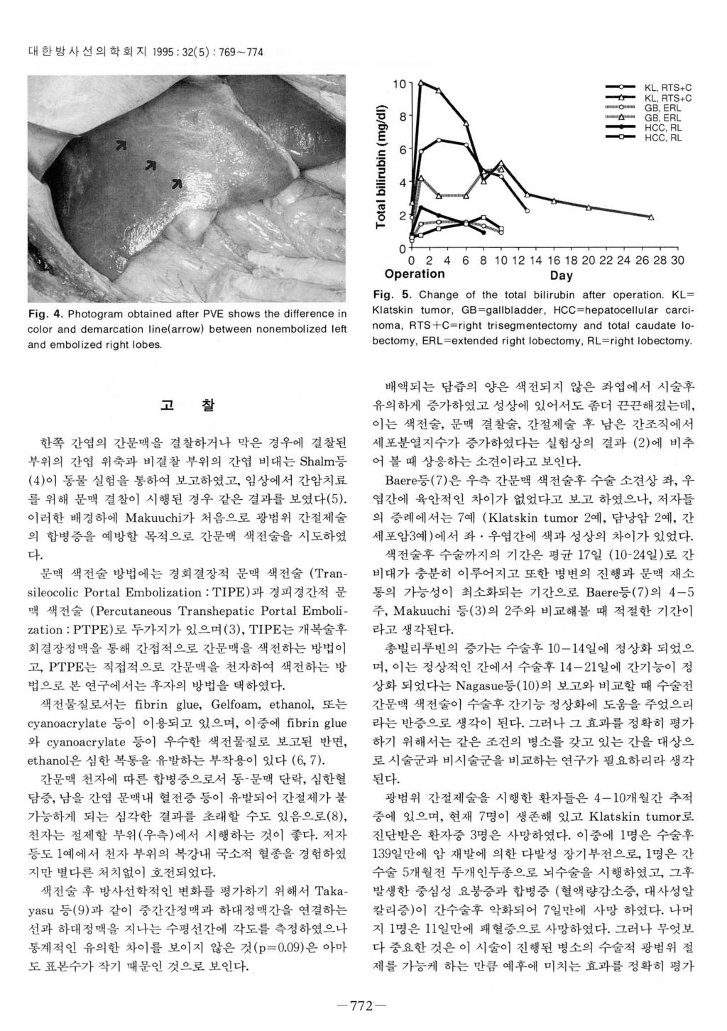 까대한방사선의학회지 1995; 32(5) : 769-774 ) F--그느---E 10 --- KL, RTS+C ---r- KL, RTS+C 1 11 11 0 Q 11 GB, ERL """11" GB, ERL - HCC, RL ~ HCC, RL ]( ζ(--~ge Fo o 2 4 