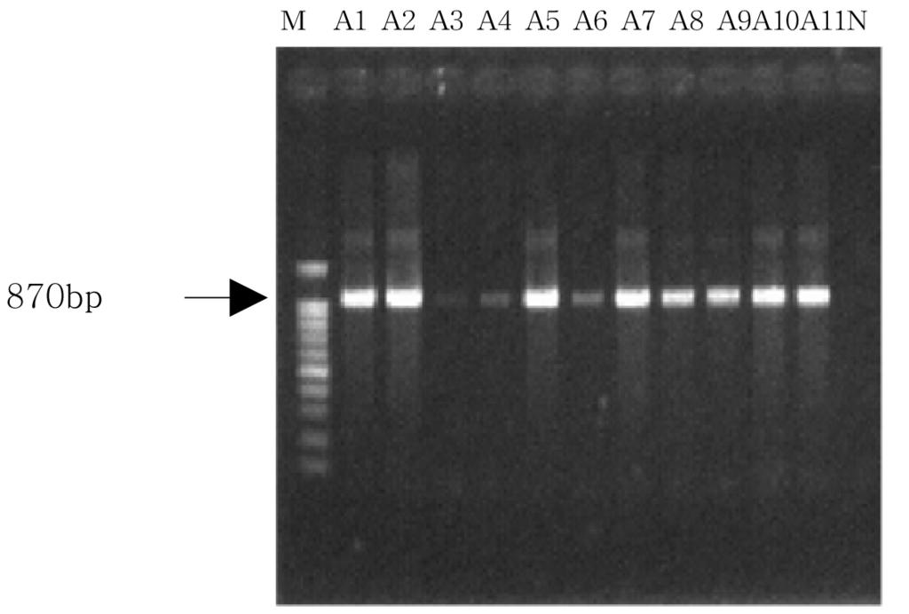 Korean J. Clin. Lab. Sci. 41(4):153-157, 2009 포함하여총 20 µl를 PCR기기에서증폭시켰다. SHV유전자증폭을위한조건은 95 에서 10분간변성을시킨후 95 에서 50초, 60 에서 50초, 72 에서 50초 30 cycle을반응시키고 72 에서 10분간반응시켰다. 6. Real-Time PCR을이용한 ESBL 유전자의증폭임상검체에서분리된 ESBL 생성 K.