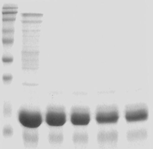 SDS-PAGE 및 IgE immunoblot 검사 : 쌀조항원을이용한 SDS-PAGE 결과, 9 kda부터 120 kda까지분포하는 12개의단백대를발견할수있었다 (Fig. 3A). 특히 9 kda과 14 16 kda의단백대는열과 simulated gastric fluid에도사라지지않는매우안정된단백대임을알수있었다 (Fig. 3B).