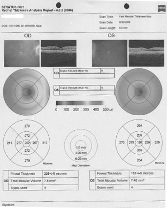 광간섭단층촬영검사 (optical coherence tomography) 에서두눈의시신경상측에서망막신경섬유층의국소적결손소견이관찰되었다. 시야검사에서는양안의전반적인감도저하소견과하측시야에국소적인감도저하소견이산발적으로발견되었으나임상적으로의미있는변화는아니었다 (Fig. 2).