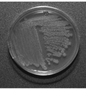 MALDI-TOF 질량분석기의 원리 및 응용 5) TLC-MALDI Thin Layer Chromatograph(TLC)는 화합물, 법의학, 천연물, 식품, 화장품 혹은 병원 및 기업체의 응용과 같은 수많은 분야에서 사용되고 있다.