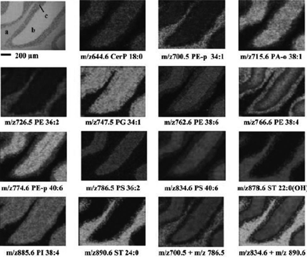 MALDI 이미징 으로 알려진 기술이다. MALDI 이 미징은 조직의 Cryostat Section으로부터 직접적으로 질 량 스펙트라 데이터를 얻는 기술이다.