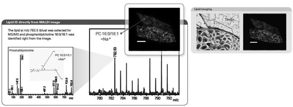 또한 최근 피크 검출 알고리즘은 전체 Isotopic Pattern 영역과 피크가 겹쳐진 경우에도 올바른 계산이 가 능하도록 설계되어 있다.