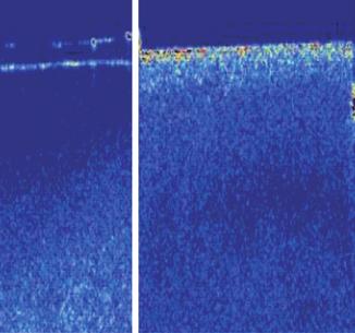 In the image, a left arrow indicates the sound area and a right arrow shows the demineralized area of the photographed specimen. Fig. 4.