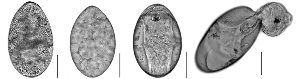 Phalee et al.: Experimental life history of Fasciola gigantica 61 A B C D Fig. 1. Photographs demonstrating the different stages of Fasciola gigantica eggs during the incubation period.