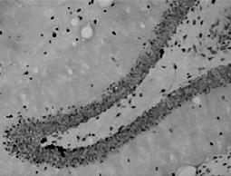 Cruz Biotech) 로반응시켰다. 이후 BDNF의 2차 antibody로 anti-rabbit antibody (1 : 5,000; Santa Cruz Biotech), IGF-1은 anti-goat antibody (1 : 5,000; Santa Cruz Biotech) 를이용하였다.