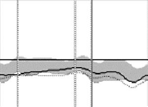 동일인에서슬관절전치환술및단일구획치환술후보행분석비교 509 Fig. 2. Kinematic and kinetic results of the hip joint in the sagittal plane. The hip motion in the sagittal plane (A) were normalized in both UKA and TKA groups.