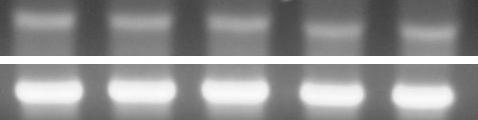 1692 임희진 서지은 장윤희 한복경 정중기 박수범 최혁준 황진아 Differentition C/EBP SREBP1 GAPDH Fig. 3. Effets of HLB nd HLB-C on dipogeni genes expression in 3T3-L1 ells. Pre: predipoytes; Sin: Sinetrol.