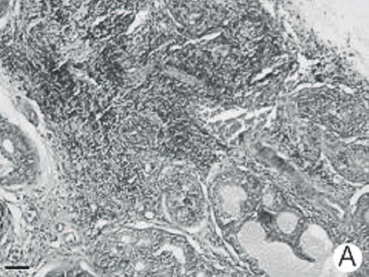 양조환 외 만성 세균성 전립선염 모델 흰쥐에서 Lycopene의 항염효과 A B C D 1351 Fig. 1. Prostate section of a chronic bacterial prostatitis rat, obtained 2 weeks after each treatment (H&E, Bar=100μm).