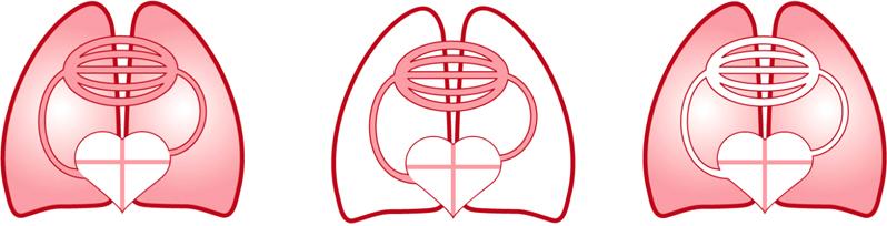 황규삼 :Cardiac output and novel hemodynamic parameters 91 경심폐열희석법을이용한새로운혈역학지표들중심정맥카테터에찬물을주입하여심장과폐를거쳐서고동맥에도달했을때온도가얼마나변화했는지를열희석커브로그릴수있다. 온도의차이는 0.3 o C 이상이적절하다 (Fig. 2).