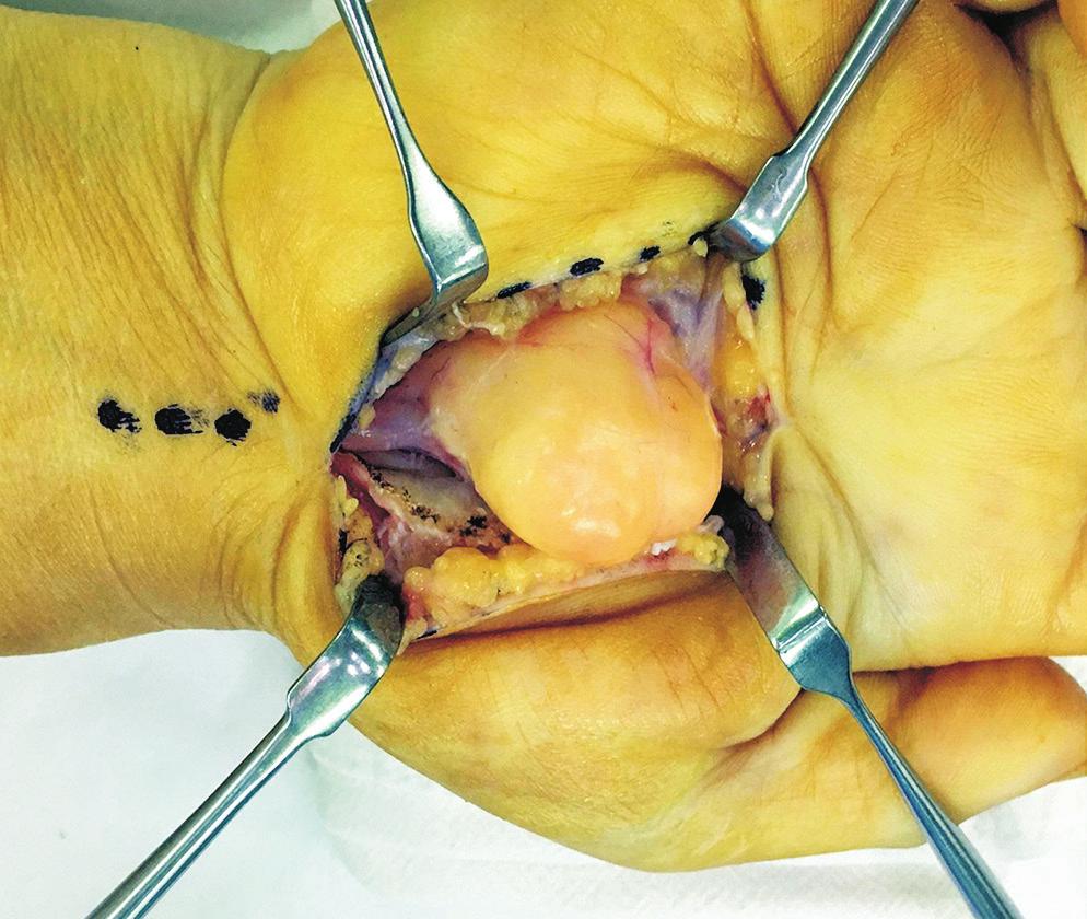 Archives of Hand and Microsurgery Vol. 24, No.