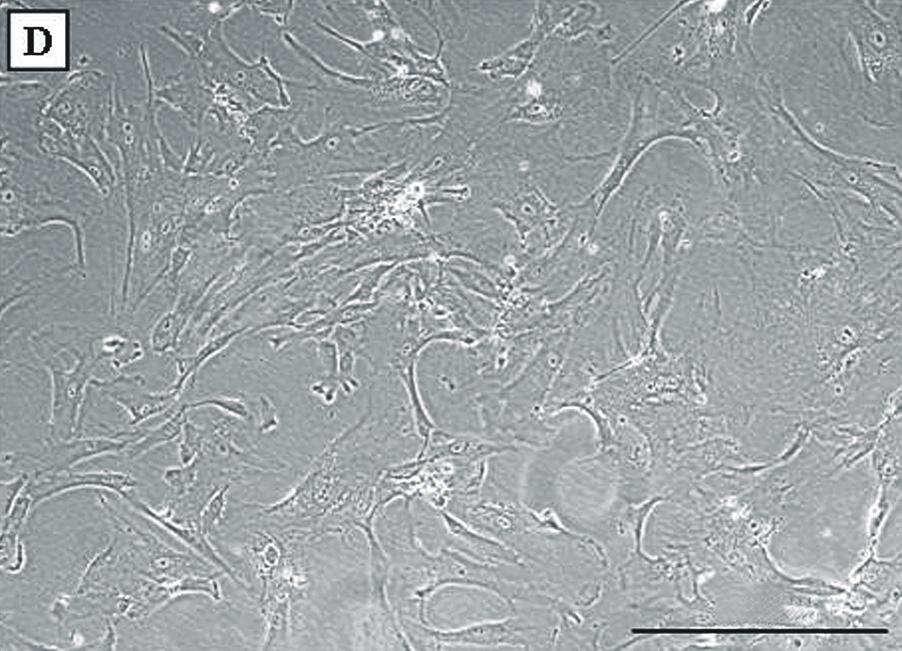 지방세포로의 분화는 oil red O (Sigma) 태 등에서 차이가 관찰되었다. 간엽줄기세포군은 섬유모 염색으로 확인하였다. 세포 모양과 유사한 형태를 보이고 있다(Fig. 1A).