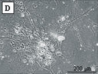 인간 제대혈 유래 간엽줄기세포군과 단일클론세포 군 간의 유전자