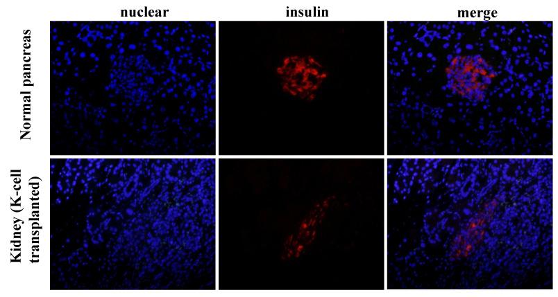 심주연외 7 인 : 제 1 형당뇨병쥐모델에서유전공학적제조 K- 세포이식을통한당뇨병의치료 Fig. 6.