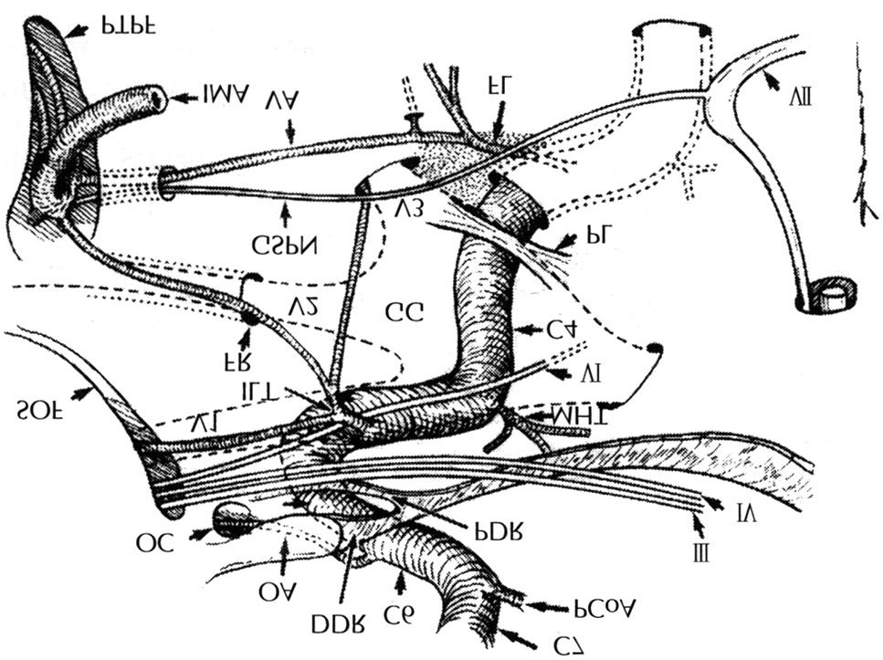 1) Vidian artery (artery of pterygoid canal) 2) Caroticotympanic artery 3) Aberrant petrous ICA 4) Carotid-basilar anastomoses 3. C3:Lacerum ICA 4. C4:Cavernous ICA A B Fig. 5.