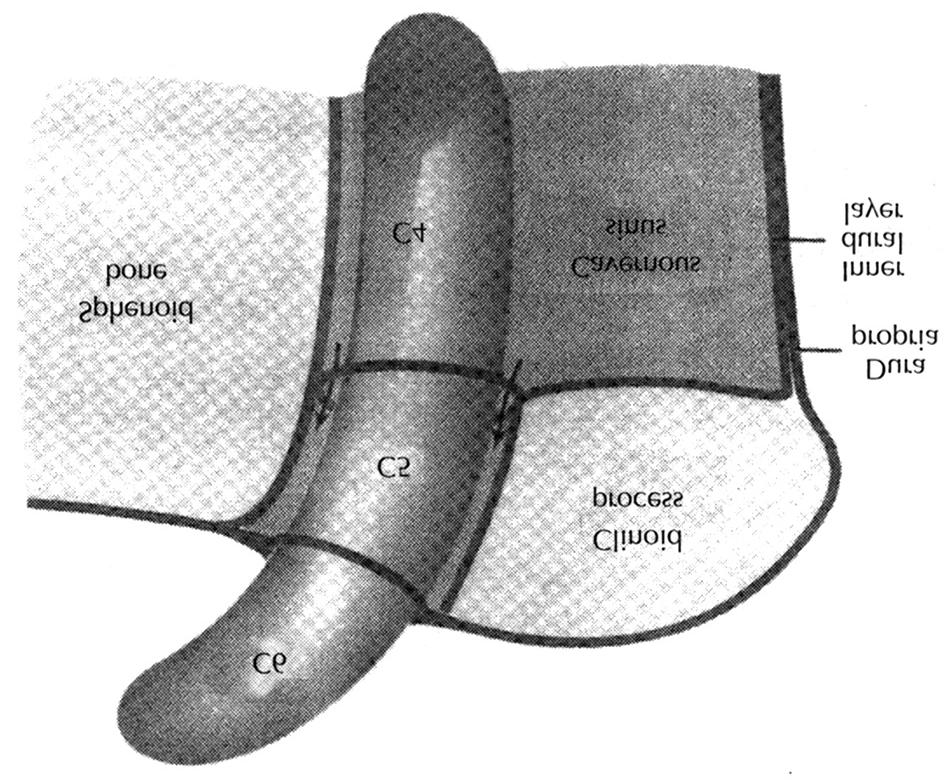 1)3)4)6) C4의 분지로는 1) posterior trunk, 2) inferolateral trunk, 및 3) medial trunk가 있다. 1) Posterior trunk (meningohypophyseal trunk MHT) 대부분의 경우 관찰되며 C4의 posterior genu 위쪽으로 기시한다.