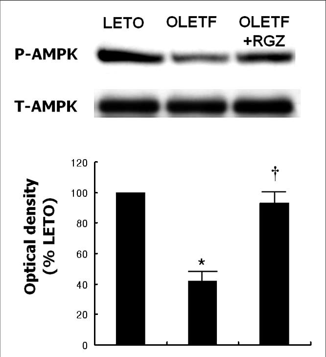 조은희외 1 인 : OLETF 쥐에서 Rosiglitazone 에의한 AMPK 의활성화및비알콜성지방간질환의호전효과 Fig. 4. Effects of rosiglitazone (RGZ) treatment on AMPK phosphorylation in the liver tissue of OLETF rat. * P < 0.05 vs.