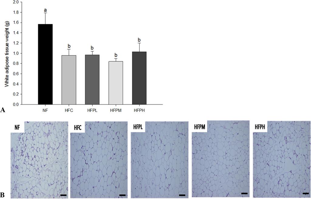 6 / 자색고구마열수추출물의지방간저항성 Fig. 4. Effects of purple sweet potato extract on lipid and mrna levels in the liver of high fat/cholesterol-fed C57BL/6 mice: (A) TC, (B) TG, and (C) mrna levels.