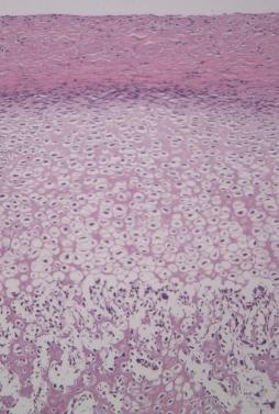 ; fibrous covering, reserve, proliferation and hypertrophic zones (Figure 4). Calcification zone and ossification zone are below the four zones (Figure 4).