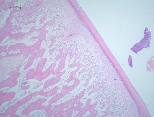 A, B Group Control shows normal condylar surface with