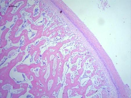 ossification zone C, D Group 10U shows no significant