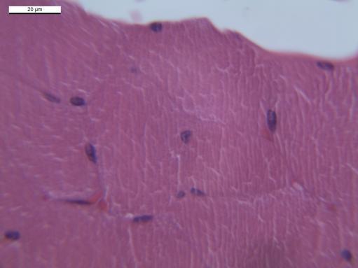 Histological analysis of the masseter muscle in