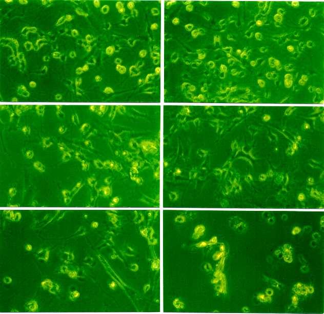 A B C D E F Fig. 2. Light microscopic findings of microglial cells treated with the Naegleria fowleri lysate in a dose-dependent manner.