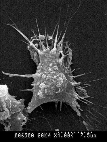 Fig. 4. SEM and TEM findings of microglial cells.