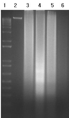 Fig. 6. DNA fragmentation of microglial cells treated with Naegleria fowleri lysate.