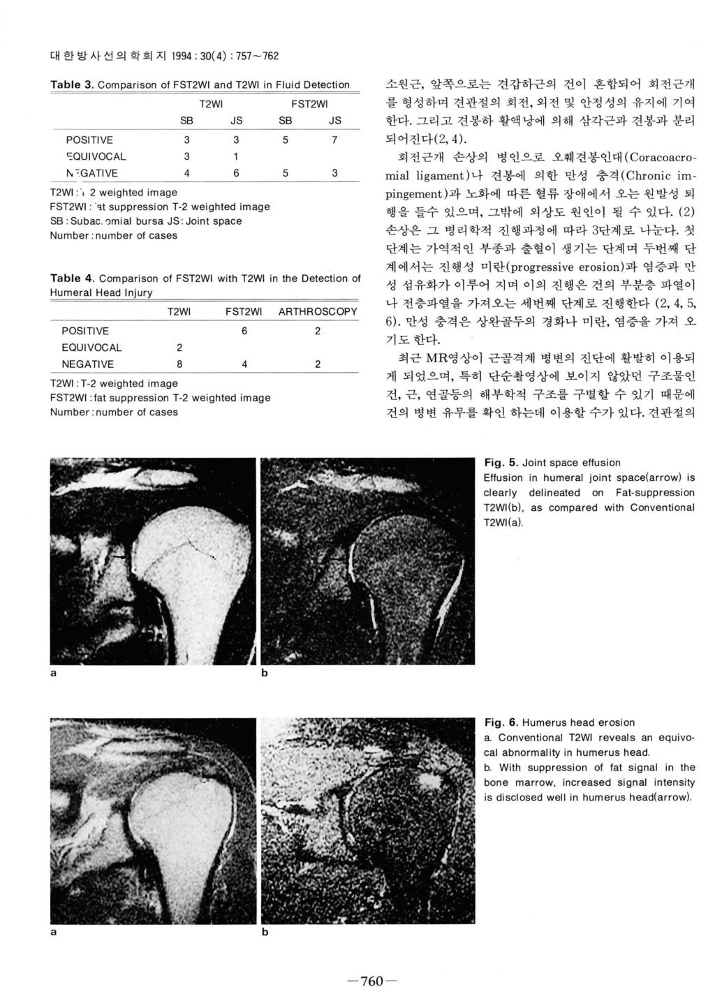 대한방사선의학회지 1994: 30(4) : 757-762 Tle 3. Comprison 01 FST2WI nd T2WI in Fluid Detection POSITIVE 던 QUIVOCAL f\.