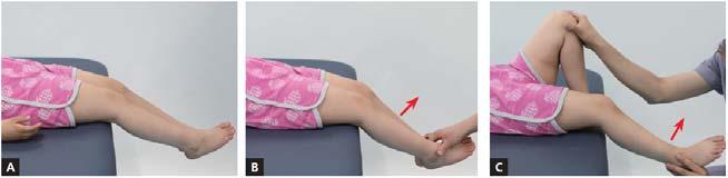 근골격계검사 ( 무릎관절 ) 근골격계검사 ( 발과발목 ) 무릎뼈위치검사 (patella alta) 폄근지연 (extensor lag) 무릎뼈가위로올라가면약 30% 의힘 ( 토크 ) 이줄어들게됨 넙다리네갈래근약화와결합되면마지막 15~20도폄이안됨검사방법