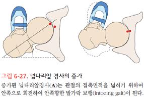 일단계다수준수술의원칙과상관없이즉각적인수술실시 엉덩관절에대한수술 안쪽돌림변형 증가된앞경사각 (anterversion) 이주요원인이됨 보행이늦거나체중지지를많이안하는아동의경우,