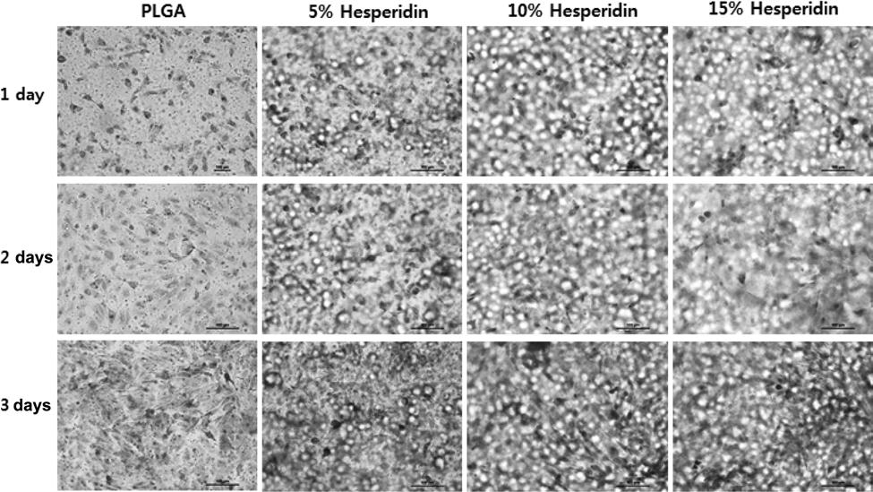 헤스페리딘 /PLGA 필름에서망막색소상피세포의부착과증식거동 29 Figure 8.