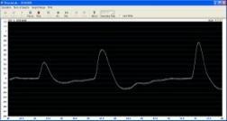 (PPG), 심박동수 (BPM), 맥파전달시간 (PTT) 동시측정 ㆍ Vector ECG(2D) 모니터링전기적심장활동에따른심전도측정 - 구성 -