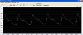 idaq-400 EDG-Amp(1) ㆍ호흡에따른심전도모니터링 BPM 을통한호흡관찰및심전도측정 ㆍ광적용적맥파 PPG 측정손가락에서말초맥파측정 구성 :