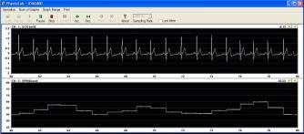 idaq-400 PPG-Amp(1) ㆍ뇌전도 EEG 모니터링뇌파 ( 후두부 ) 를이용한알파파측정 - 구성 - idaq-400 Bio-Amp(1)