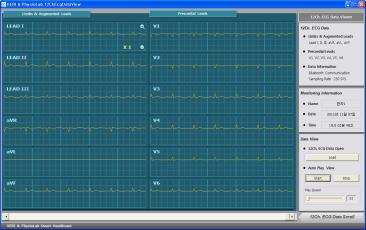 12 채널착용형무선심전도계 Realtime Monitoring