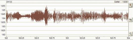 ECG-KIT SimDAQ-KIT ECG signal + 60Hz