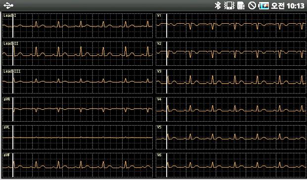 Power Only 250/500/1k/2k/4k SPS 500 SPS