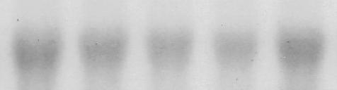 C, control; line 1~4 ordinary, 1, cerebral cortex; cerebellum, hippocampus, spinal cord. Fig. 2. Northern blot analysis showing the effects of actinomycin D and cycloheximide on irp94 mrna.