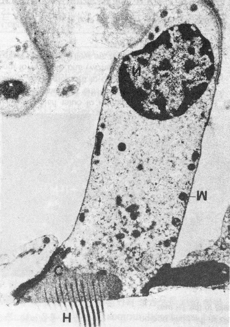 이외에 모 (cilia)의 탈락과 같은 변화를 관찰할 수 있었고 세포 막의 부분적 파괴, 세포질(cytoplasm)의 공포화(vacuolization) 및 소기관(organell)의 종창 등 와우유 모세포의 변성을 관찰할 수 있었다(Fig. 3 Fig. 5). Fig. 2.