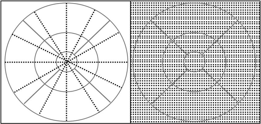 - 대한안과학회지 2009 년제 50 권제 7 호 - Figure 5. Illustration of how time domain and spectral domain OCT samples the retina differently (Right= SD-OCT; Left=TD-OCT). Table 4.