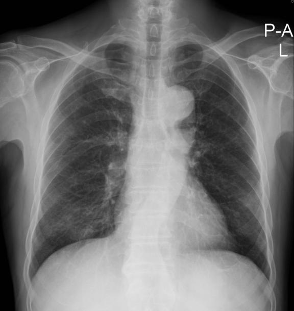 intravenous catheter Figure 1.