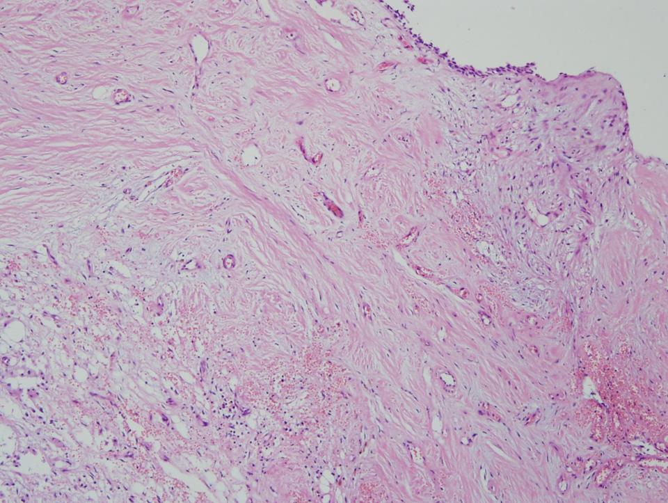 - Kyung Sun Ha, et al. Periodic hypokalemic paralysis - Figure 3. Concentration of potassium (K+) during chemotherapy.