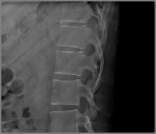 narrowing 3) 연골및관절간격 (Cartilage or joint space) 4) 연부조직 (Soft tissue) 골절,