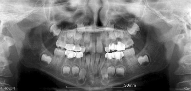 a b Fig. 4. Initial panoramic view of case 2.