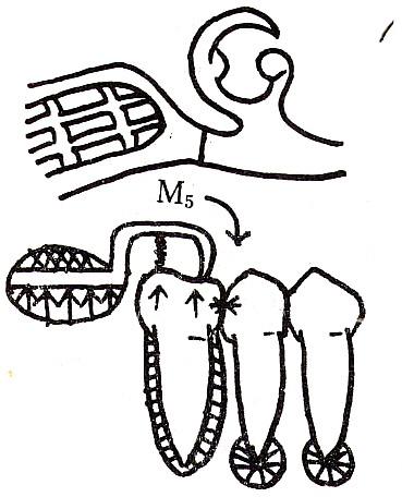 Case 4 : Distal connection 과근심레스트및 원심레스트를갖는 back-action 클래스프 Case 5 : Mesial connection 과근심레스트및 원심레스트를갖는 back-action 클래스프 이경우는근심레스트가 metal me-sh frame 에직결되어있으므로, 제2 소구치에작용하는하중이 metal me-sh frame